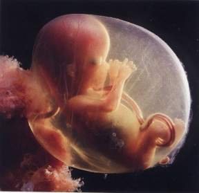 foetus_15semaines.jpg